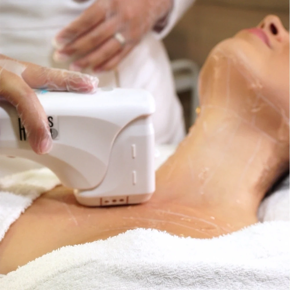 Ultrassom Microfocado HERUS HIFU Facial | Onodera Estética